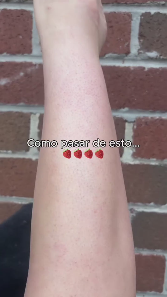 DIABESKIN Restaura Tu Piel y Elimina la Queratosis Pilaris